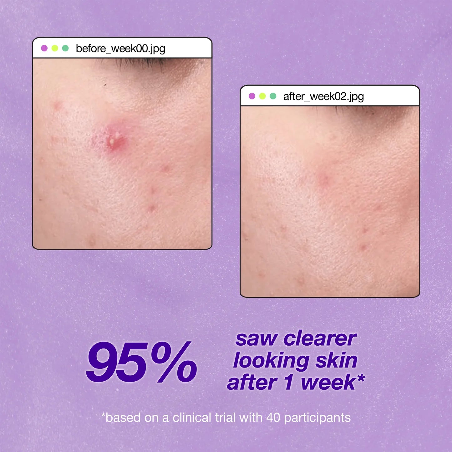 Breakout Clearing Liquid Peel (7449892290738)