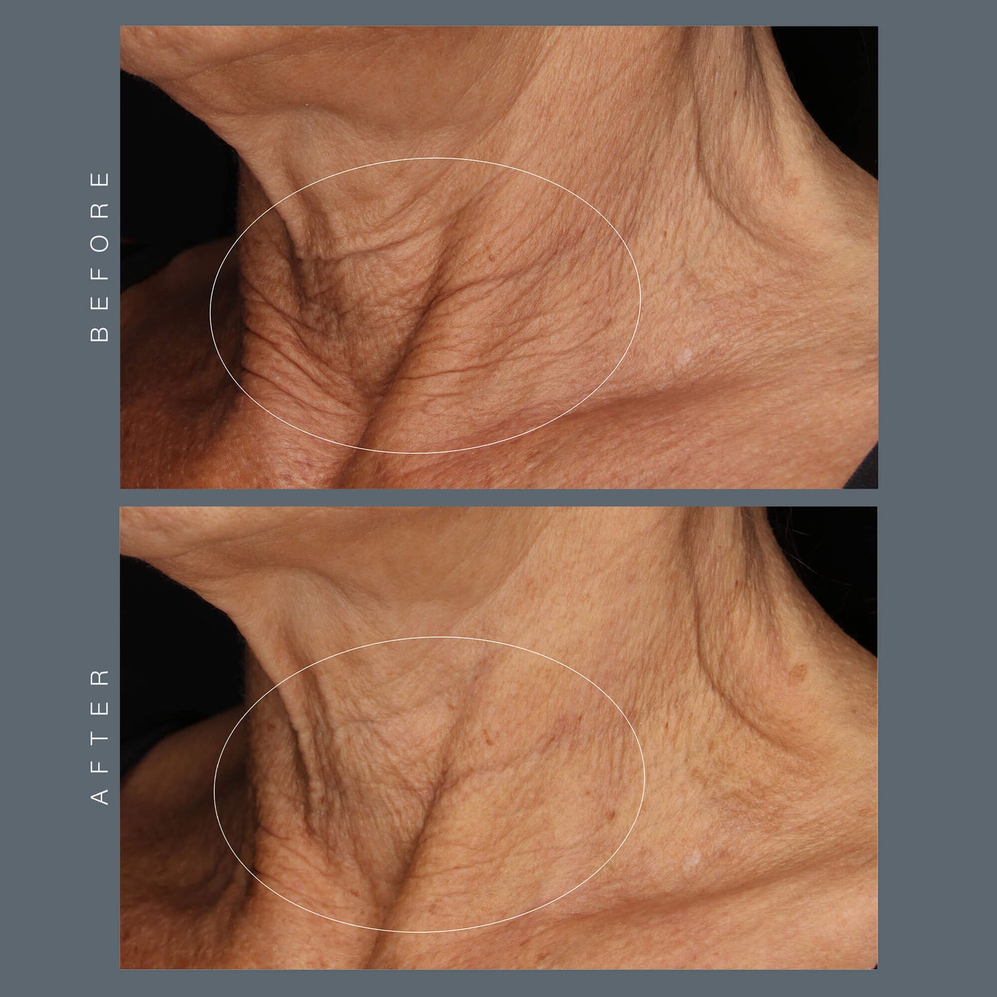 Neck Fit Contour Serum (6543681061042)