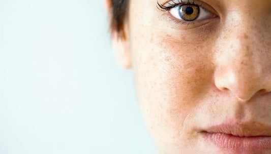 behind the brown spot
