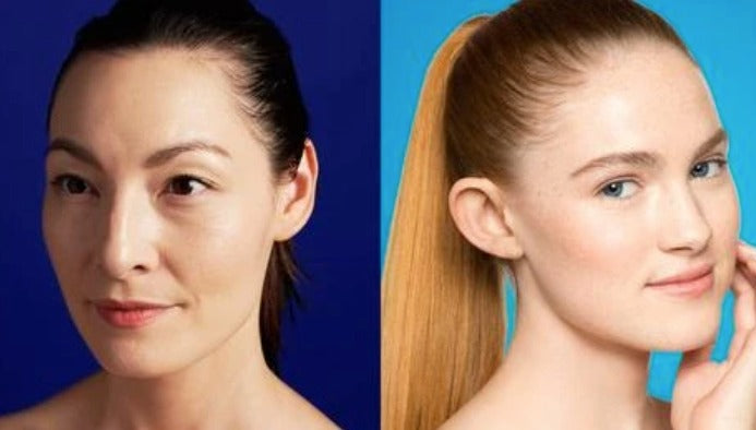 The Difference Between Adult Acne And Teen Acne