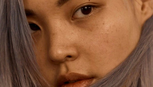 Does Sex Cause Breakouts?