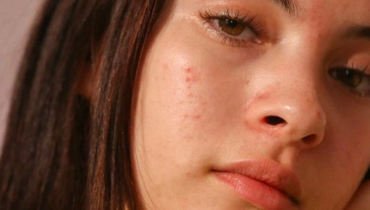 What's Going On With My Skin?
