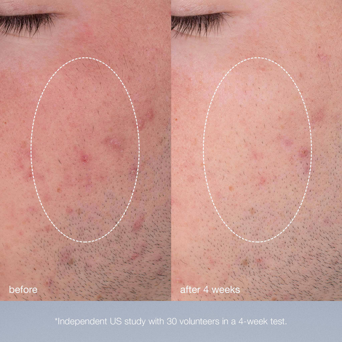 Daily Microfoliant®