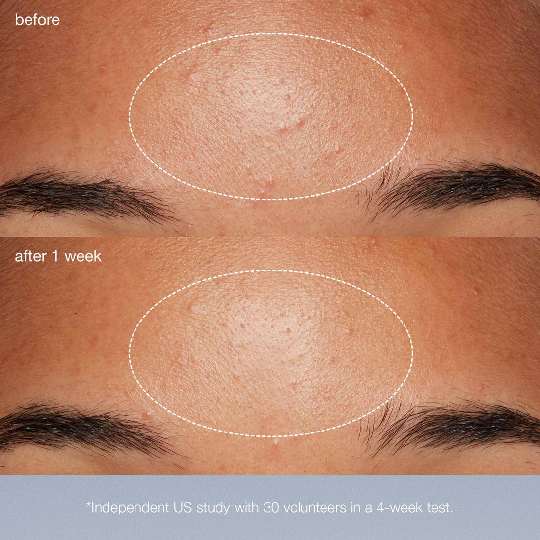 Daily Microfoliant®
