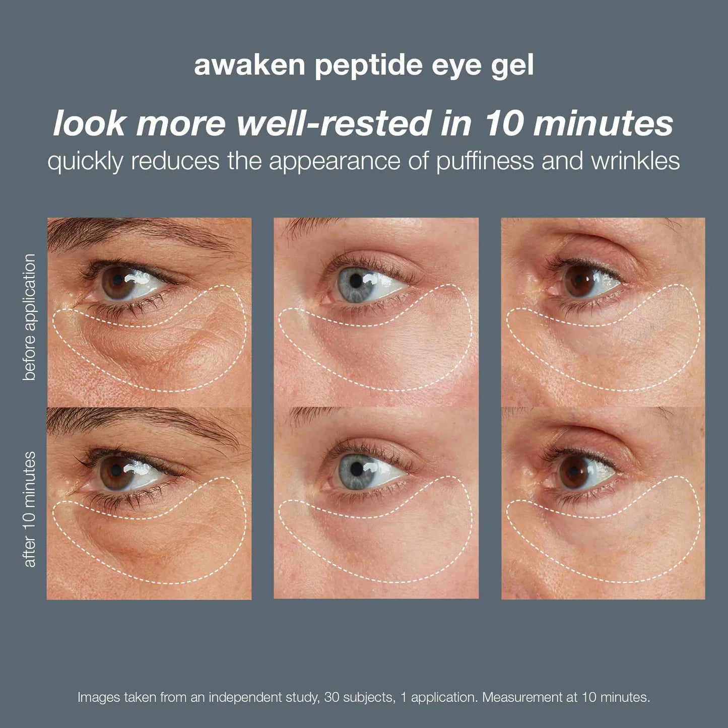 Awaken Peptide Eye Gel (7179210522802)