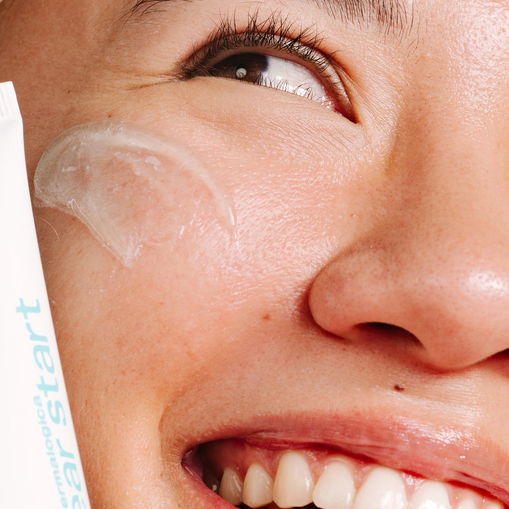 Clear Start Breakout Clearing Kit (7143871873202)