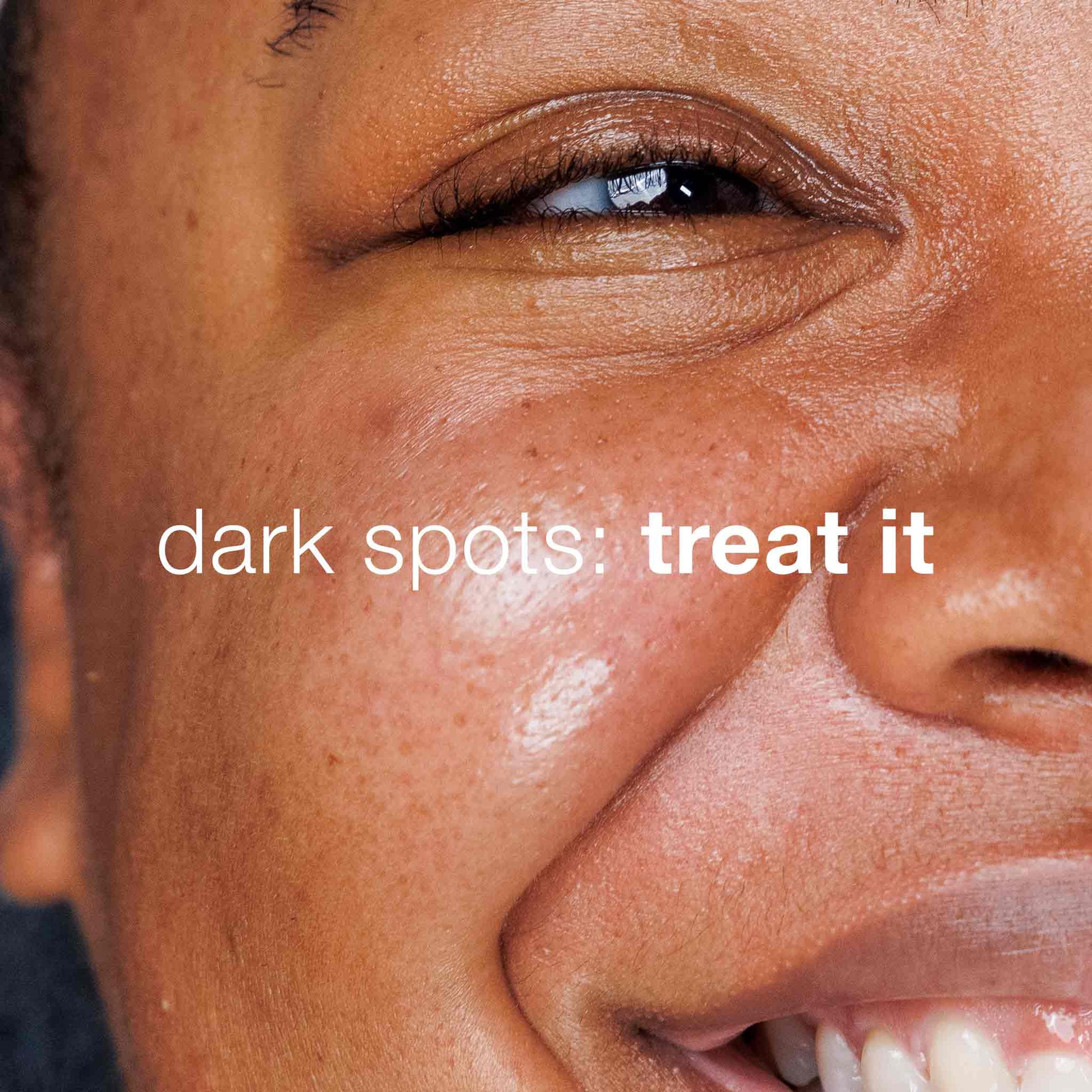Dark Spot Solutions Kit (7179215896754)