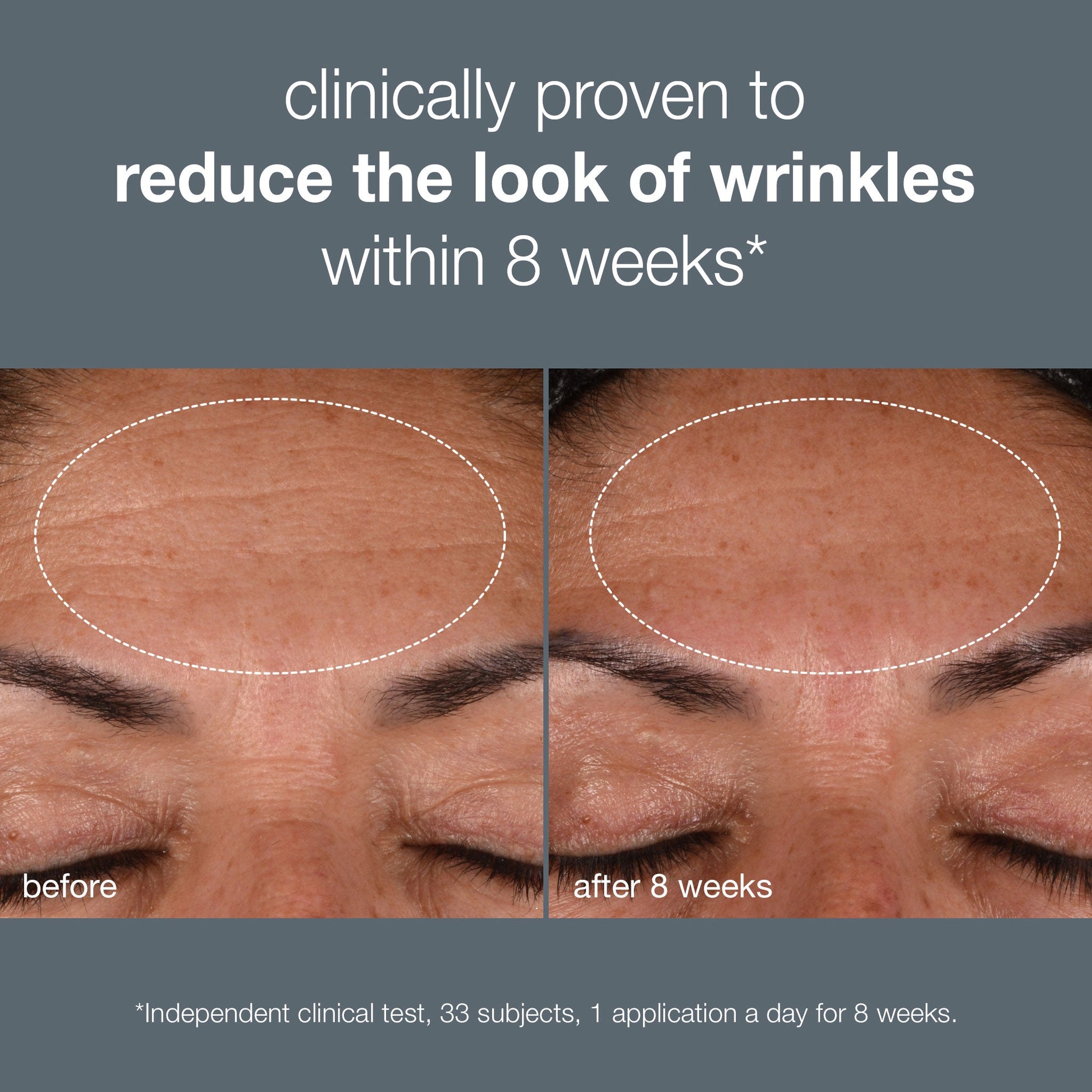 Dynamic Skin Recovery SPF50 (20% OFF) (6541200523442)