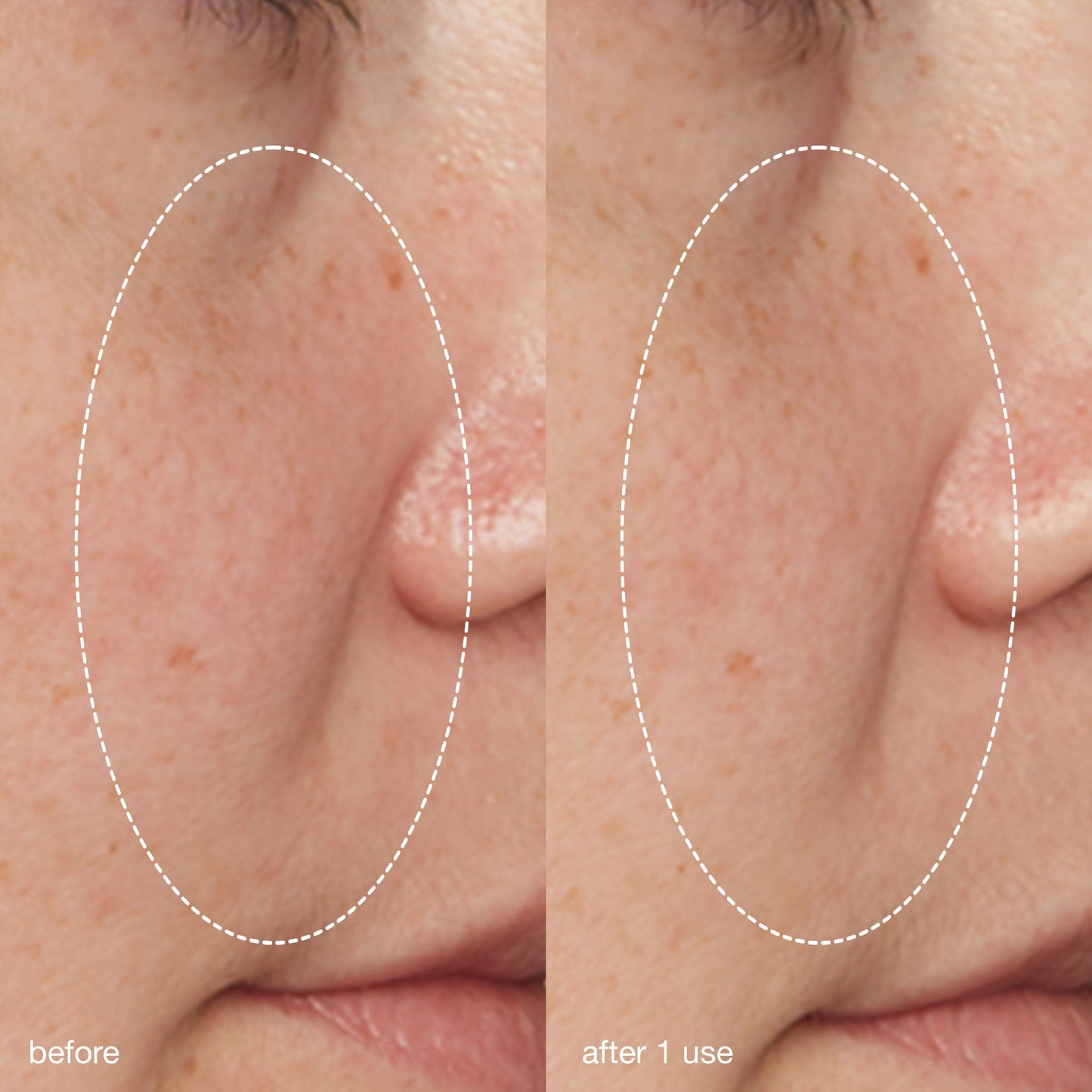 Liquid Peelfoliant (8456760721738)
