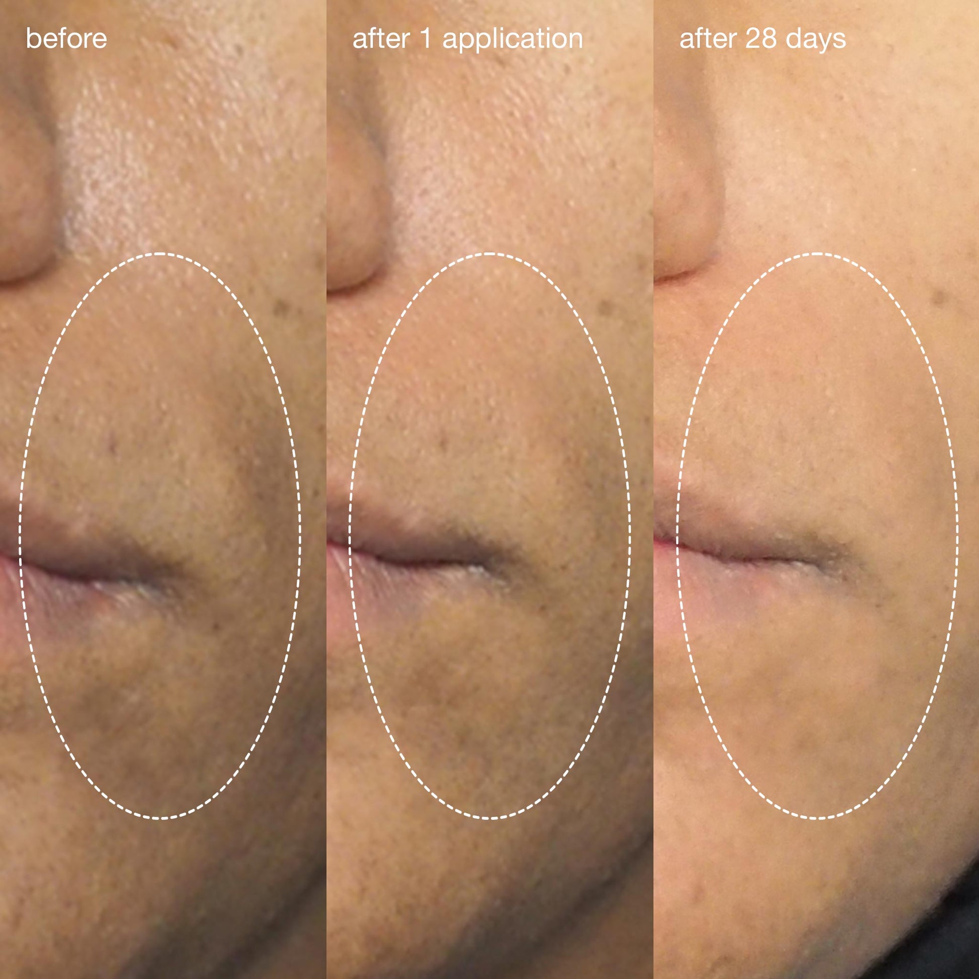 Liquid Peelfoliant (20% Off) (8456760721738)