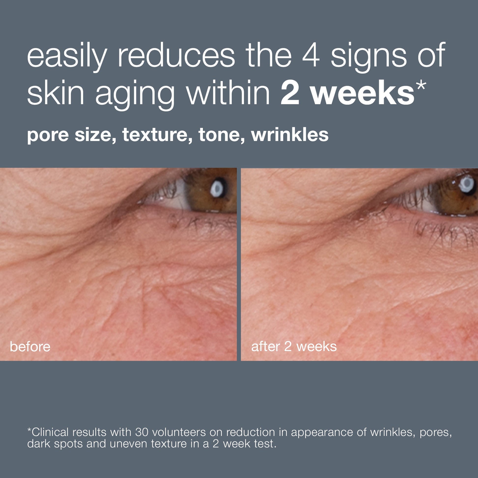 Dynamic Skin Retinol Serum (7516303655090)
