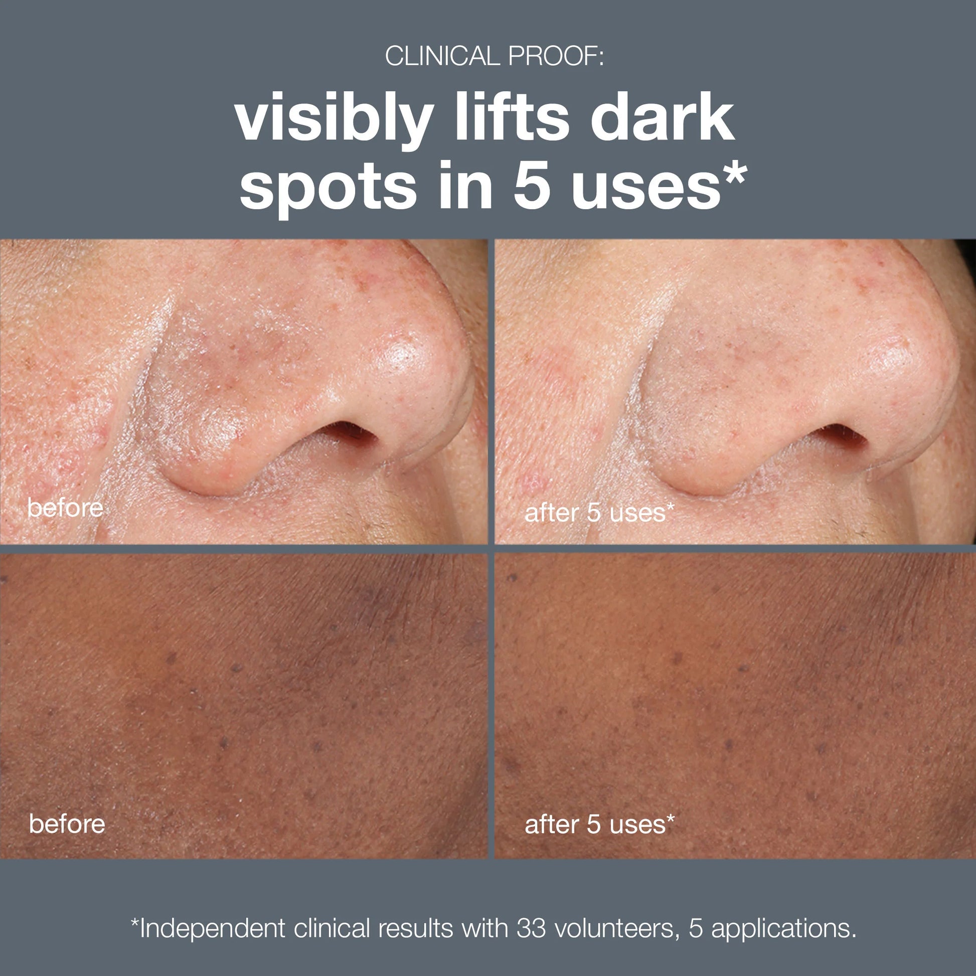 Powerbright Dark Spot Peel (8694112616778)